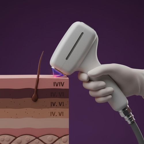 Skinology Pro Advanced Diploma in Fitzpatrick 4–6 Laser Safety
